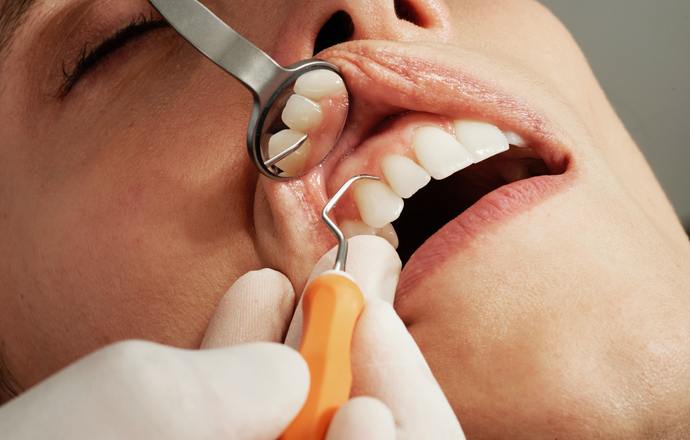 Martwy ząb – czym jest i jak sobie z nim poradzić?