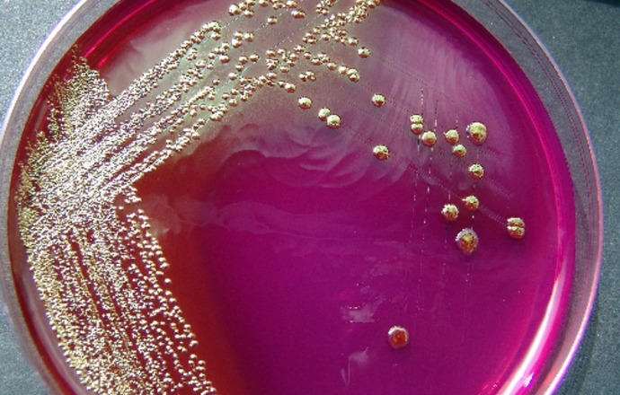 Mikroflora człowieka- czyli bogactwo mikrobów w naszym ciele
