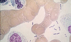 Infekcje wywołane spożyciem drobnoustrojów- część III