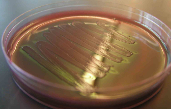 Zmodyfikowane E. coli potrafią zidentyfikować i zneutralizować patogeny - sukces biologii s