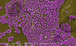 Indoliny jako nowy sposób zwalczania lekooporności Staphylococcus Aureus (MRSA) 