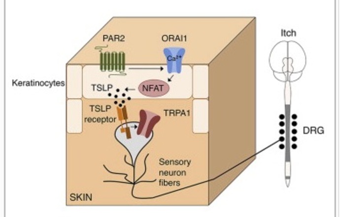 Blokowanie neuronów czuciowych może zapobiec objawom swędzenia towarzyszącym wypryskowi