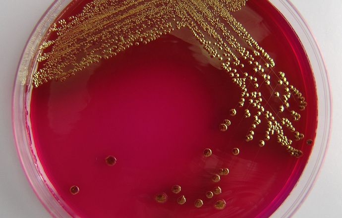 Odkryto nową bakterię w jelicie człowieka
