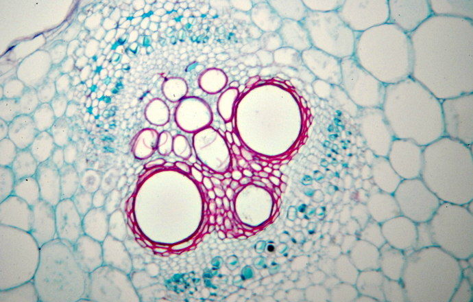 Porównanie fibroblastów i mezenchymalnych komórek macierzystych pochodzących ze skóry i tka