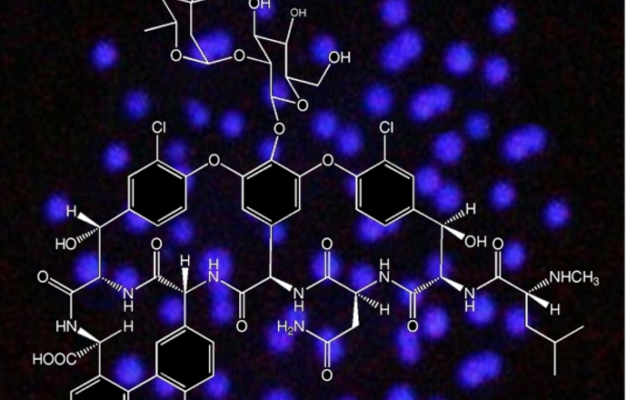 Czy fluorescencyjne antybiotyki pomogą w diagnostyce infekcji pooperacyjnych?