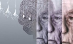 Podsumowanie roku 2013 w zakresie doniesień naukowych dotyczących choroby Alzheimera