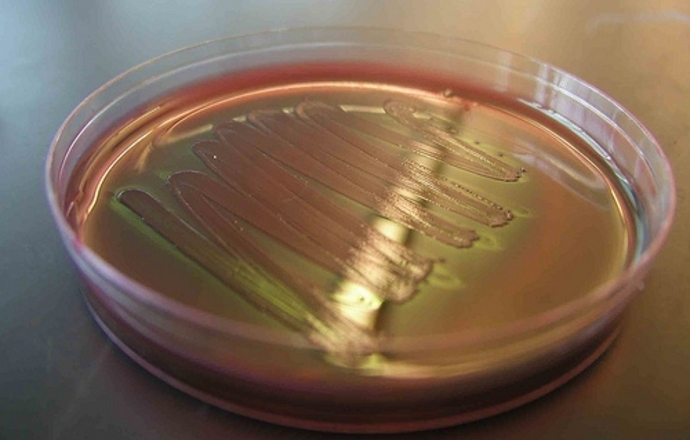 Nowy mechanizm oporności bakterii na antybiotyki