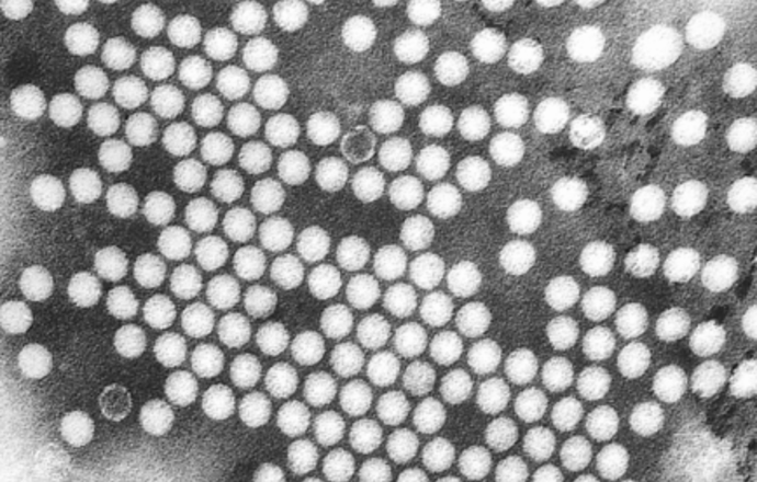 Rzadki wirus atakuje i wywołuje objawy jak wirus polio