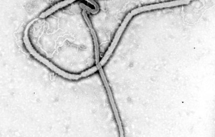 Szansa na skuteczną broń w walce ze śmiercionośnymi wirusami Ebola i Marburg