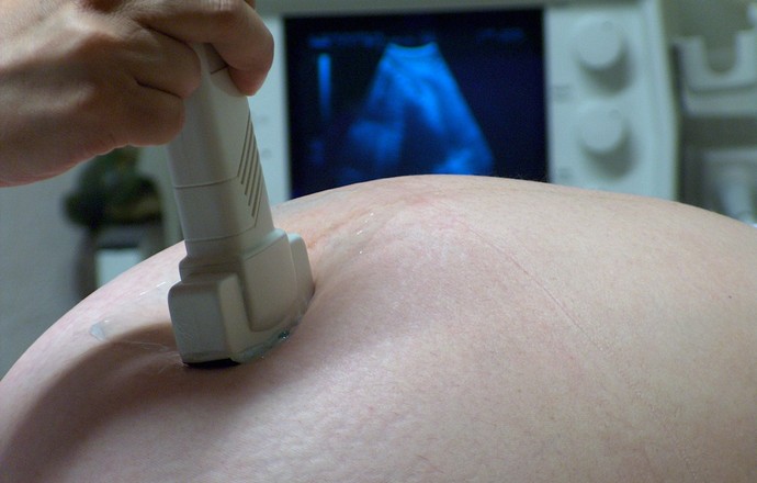 Nowa era nieinwazyjnej diagnostyki prenatalnej