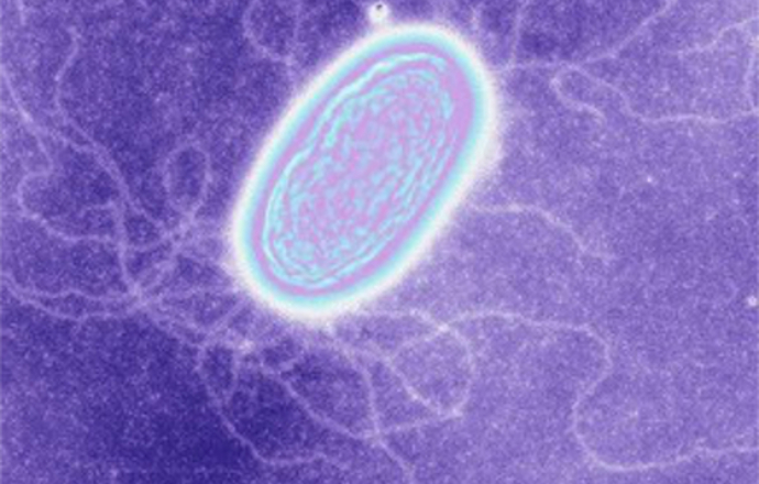 Bakterie – żywią się elektronami i tworzą biokable