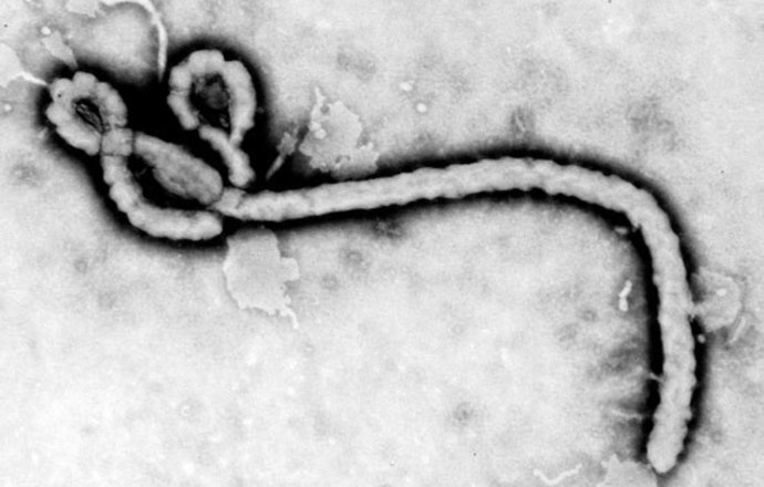Przełom w badaniach nad lekiem przeciwko Eboli. Nowy peptyd pozwoli na szybki skrining