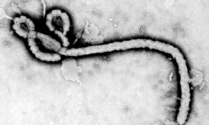 Przełom w badaniach nad lekiem przeciwko Eboli. Nowy peptyd pozwoli na szybki skrining