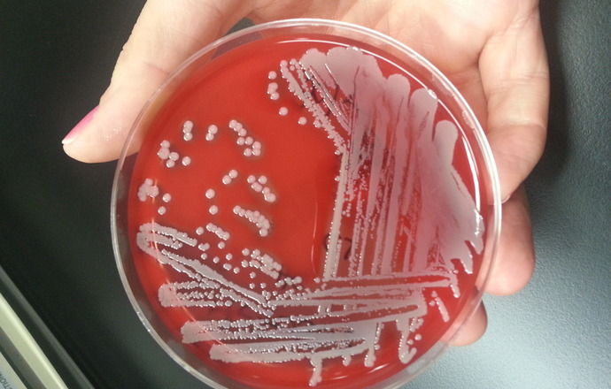 O krok przed bakteriami