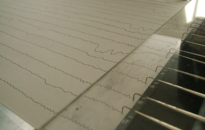 Czy muzyka może pomóc w leczeniu epilepsji?