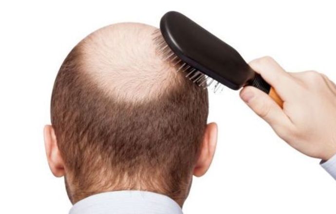 Włos Ci więcej z głowy nie spadnie – czyli o klonowaniu włosów