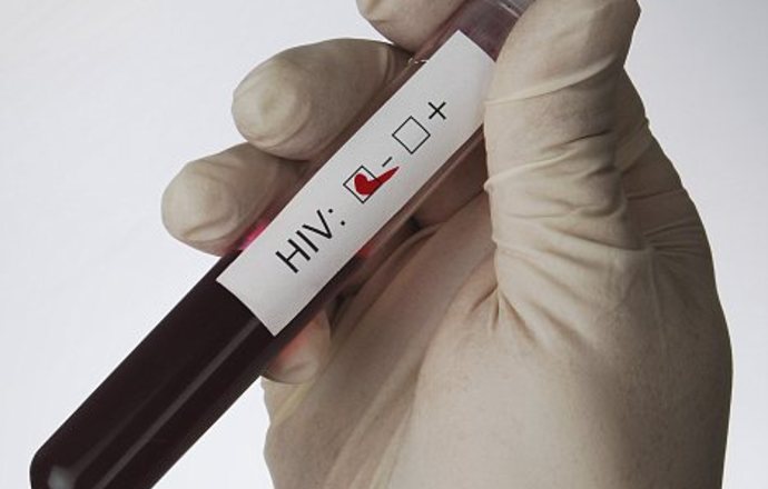 Truvada skutecznie zapobiega HIV i jest dostępna w Europie