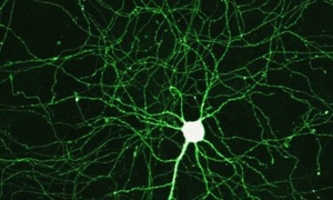 Neurony przemieszczają się w mózgu jeszcze po urodzeniu - rewolucyjne odkrycie!