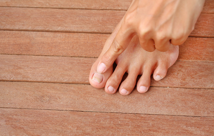 Onycholiza - choroba paznokci spowodowana używaniem nieodpowiednich preparatów