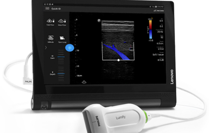 Mobilne USG – nowa era badań ultrasonograficznych 