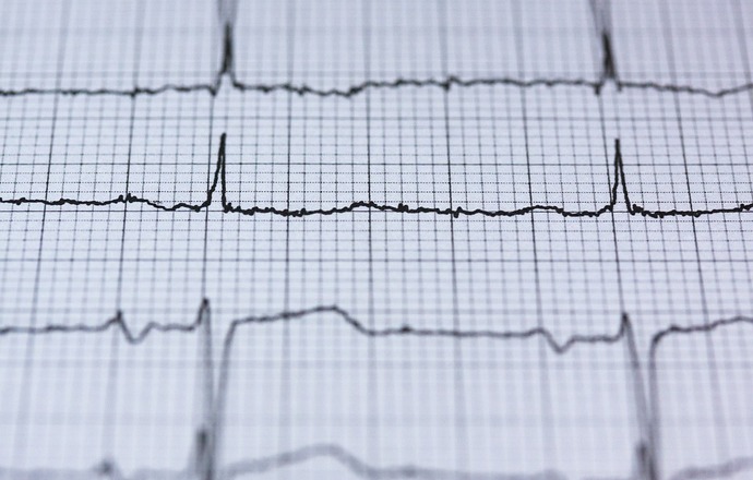 Wyścig z czasem – diagnostyka zawałów serca