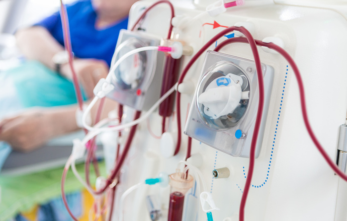 Najnowsza technologia w hemodializie już w Polsce