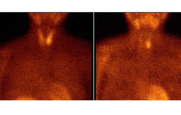 Scyntygrafia:  izotopy promieniotwórcze w precyzyjnej diagnostyce obrazowej