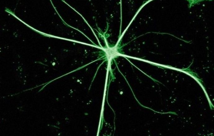 Rzucając cień na neurony. Czy komórki glejowe są ważniejsze?