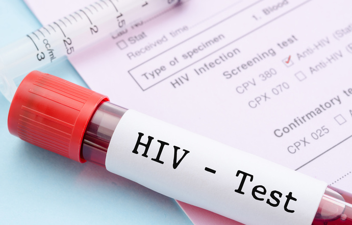 HIV to nie wyrok – rusza Europejski Tydzień Testowania w kierunku HIV