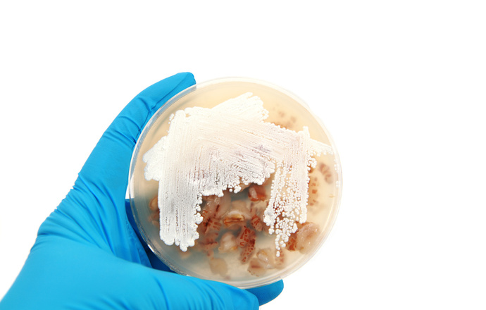 Nowo odkryty szczep Streptomyces skuteczny w walce z superbakteriami
