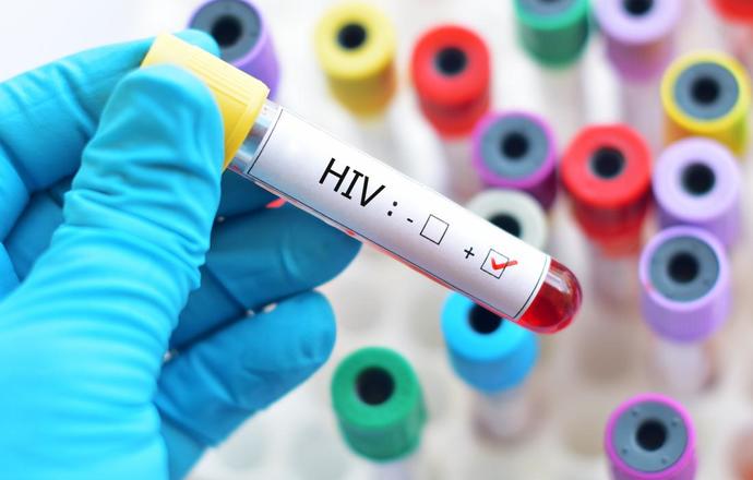 Chińscy naukowcy walczą z HIV przy użyciu CRISPR! 