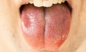 Tabletki ulegające rozpadowi w jamie ustnej