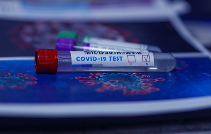 W Małopolskim Centrum Biotechnologii rozpoczyna się diagnostyka koronawirusa