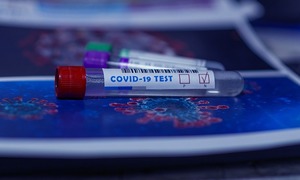 W Małopolskim Centrum Biotechnologii rozpoczyna się diagnostyka koronawirusa