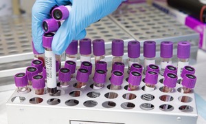 Australijscy naukowcy opracowali 20-minutowy test krwi na koronawirusa