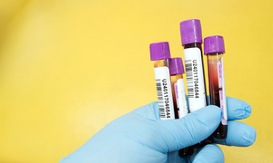Biomed-Lublin rozpoczął wytwarzanie immunoglobuliny anty-SARS-CoV-2 z osocza ozdrowieńców