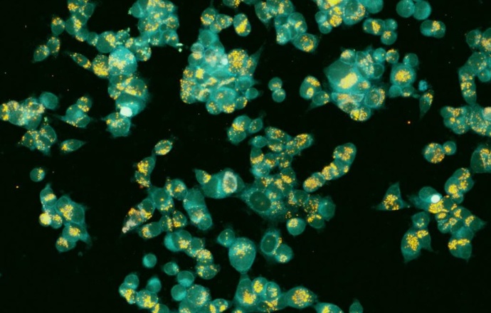 Fluorescencyjne sondy wykryją jony cynku w komórkach