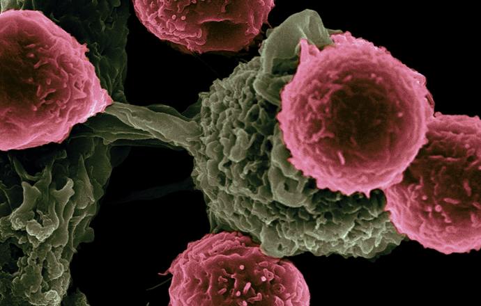 Wszystkie nowotwory mają wspólną cechę. Nowe odkrycie naukowców