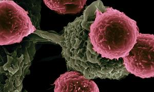 Wszystkie nowotwory mają wspólną cechę. Nowe odkrycie naukowców
