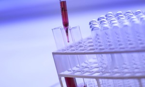 Ruszyły badania ex vivo leku PolEpi – innowacyjnej polskiej terapii na raka jajnika