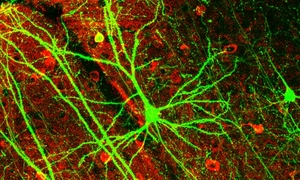 Psylocybina indukuje szybki i trwały wzrost liczby połączeń nerwowych w korze czołowej mózg