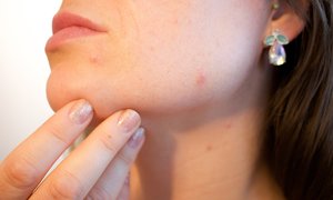 Badania dermatologiczne kosmetyku