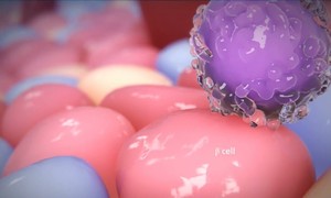 PolTREG otrzyma z NCBR 9,3 mln zł dofinansowania na rozwój terapii TREGS w stwardnieniu roz