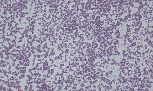 Staphylococcus epidermidis przyczynia się do utrzymania homeostazy bariery ochronnej skóry 