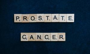 Mimo postępów w leczeniu, rośnie śmiertelność z powodu raka prostaty
