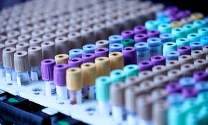 Nowe rozporządzenie w sprawie wyrobów medycznych do diagnostyki in vitro – rewolucja w praw