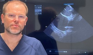 Prof. Jakub Baran o ICE ablation: „Wyższa wiarygodność anatomii serca to większe bezpieczeń
