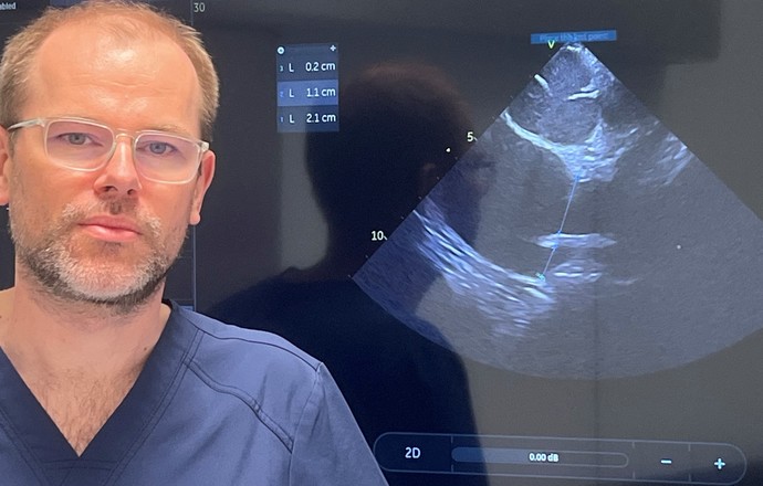 Prof. Jakub Baran o ICE ablation: „Wyższa wiarygodność anatomii serca to większe bezpieczeń