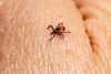 Powikłania sercowe po boreliozie – zagrożenie, o którym mało się mówi