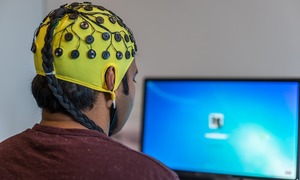 Innowacyjne elektrody typu stick-and-play – rewolucja w monitorowaniu EEG i przyszłość neur